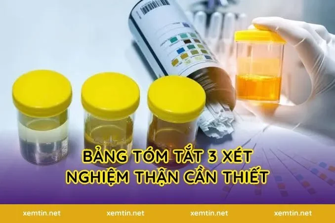 Bảng tóm tắt 3 xét nghiệm thận cần thiết