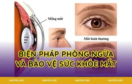 Biện pháp phòng ngừa và bảo vệ sức khỏe mắt