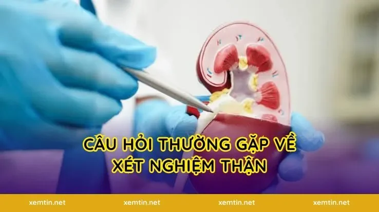 Câu hỏi thường gặp về xét nghiệm thận