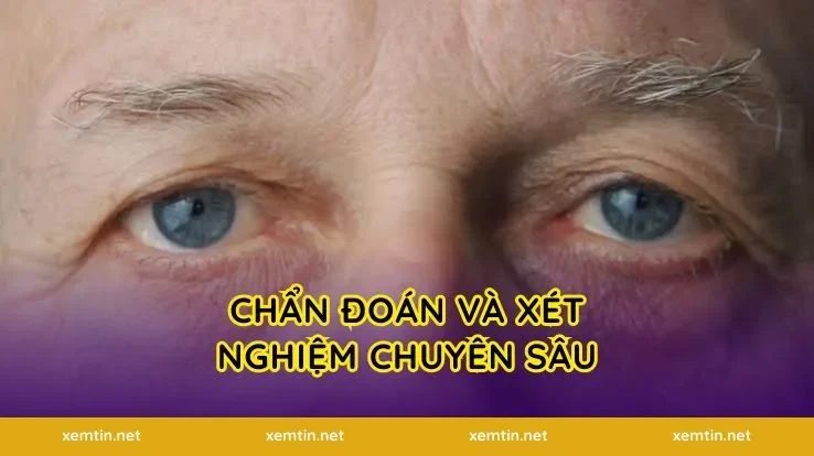 Chẩn đoán và xét nghiệm chuyên sâu