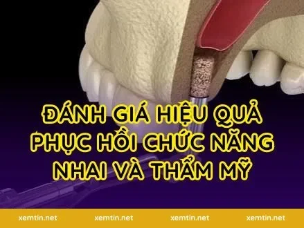 Đánh giá hiệu quả phục hồi chức năng nhai và thẩm mỹ
