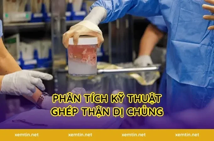 Phân tích kỹ thuật ghép thận dị chủng
