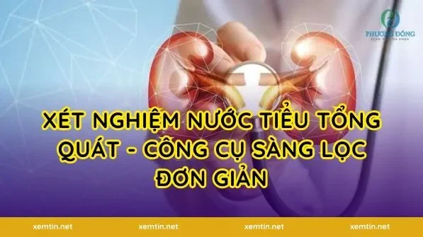 Xét nghiệm nước tiểu tổng quát - Công cụ sàng lọc đơn giản
